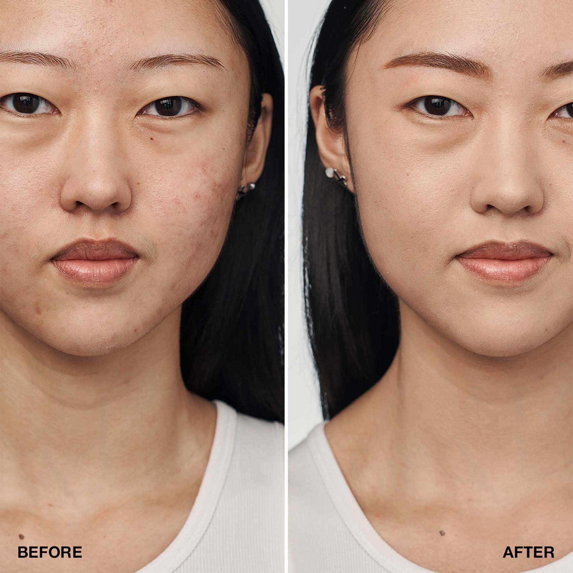 Clinique Even Better Clinical Serum Foundation SPF 20 30 ml - KY19030000 CN 28 Ivory φωτογραφία