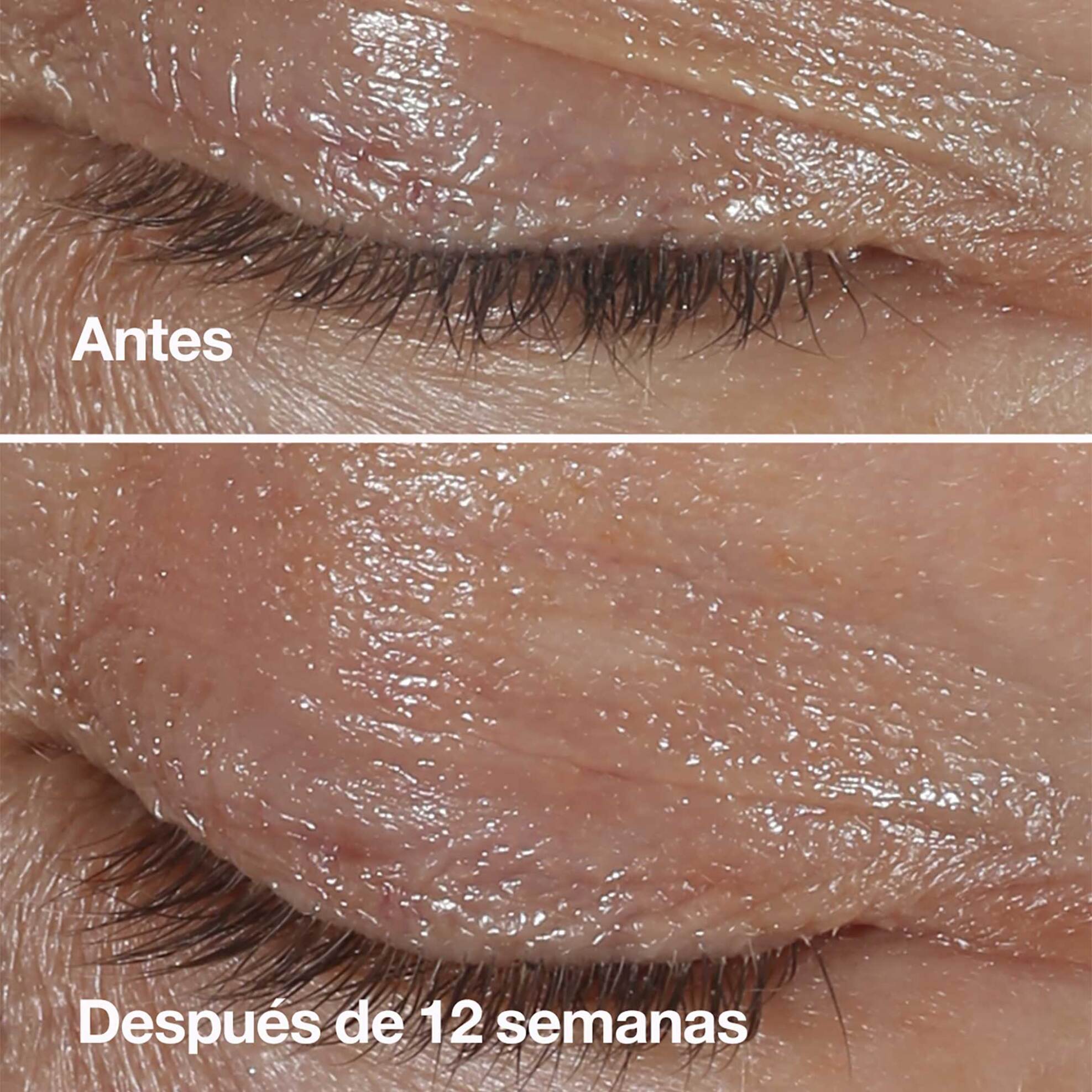 Clinique Smart Clinical Repair Wrinkle Correcting Eye Cream 15 ml - V1AX010000 φωτογραφία