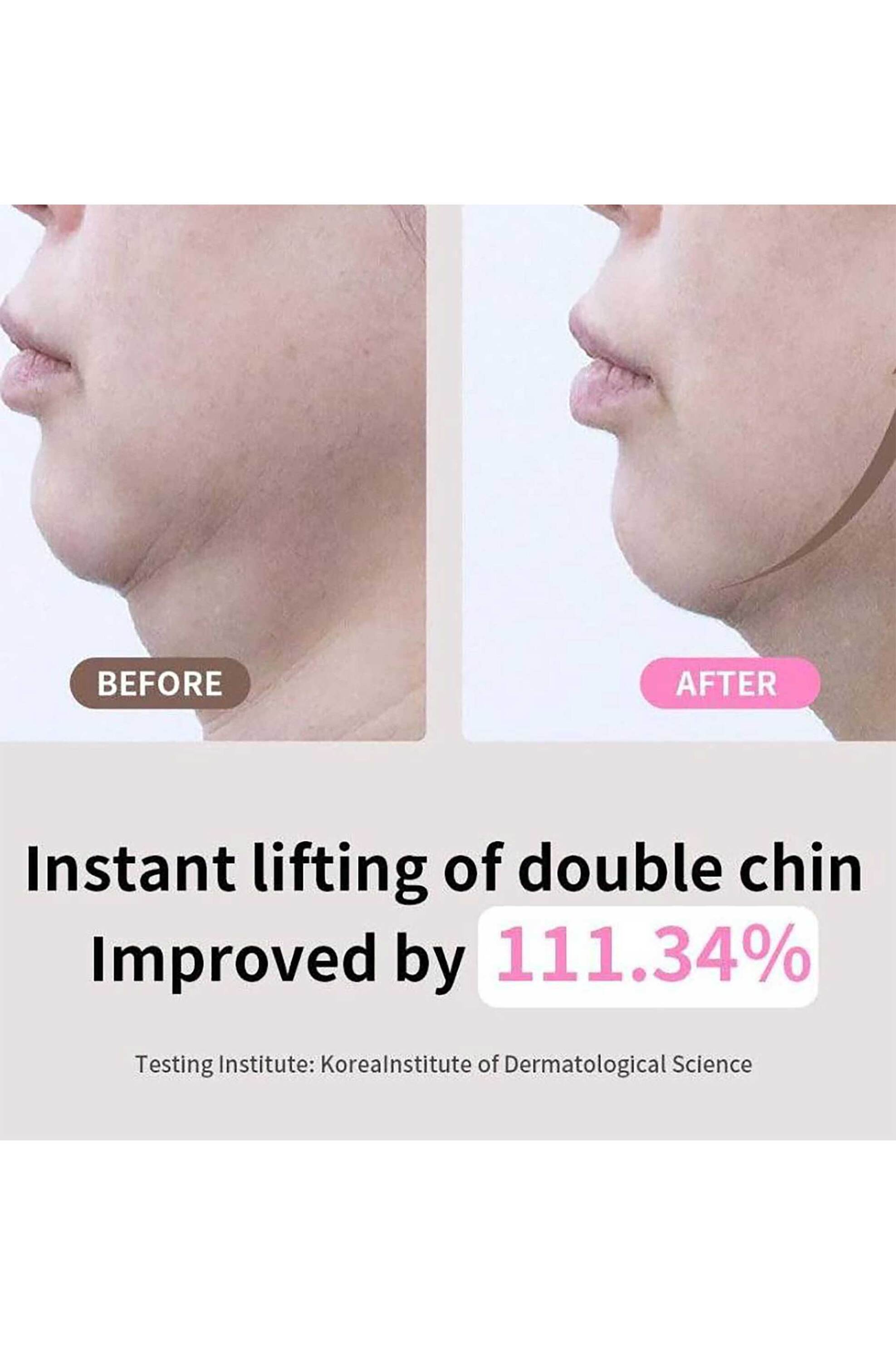 Mediheal Retinol Collagen Ampoule Lifting Mask - Μάσκα Σύσφιξης Και Ανόρθωσης Του Οβάλ 30 ml - 8809936740521 φωτογραφία