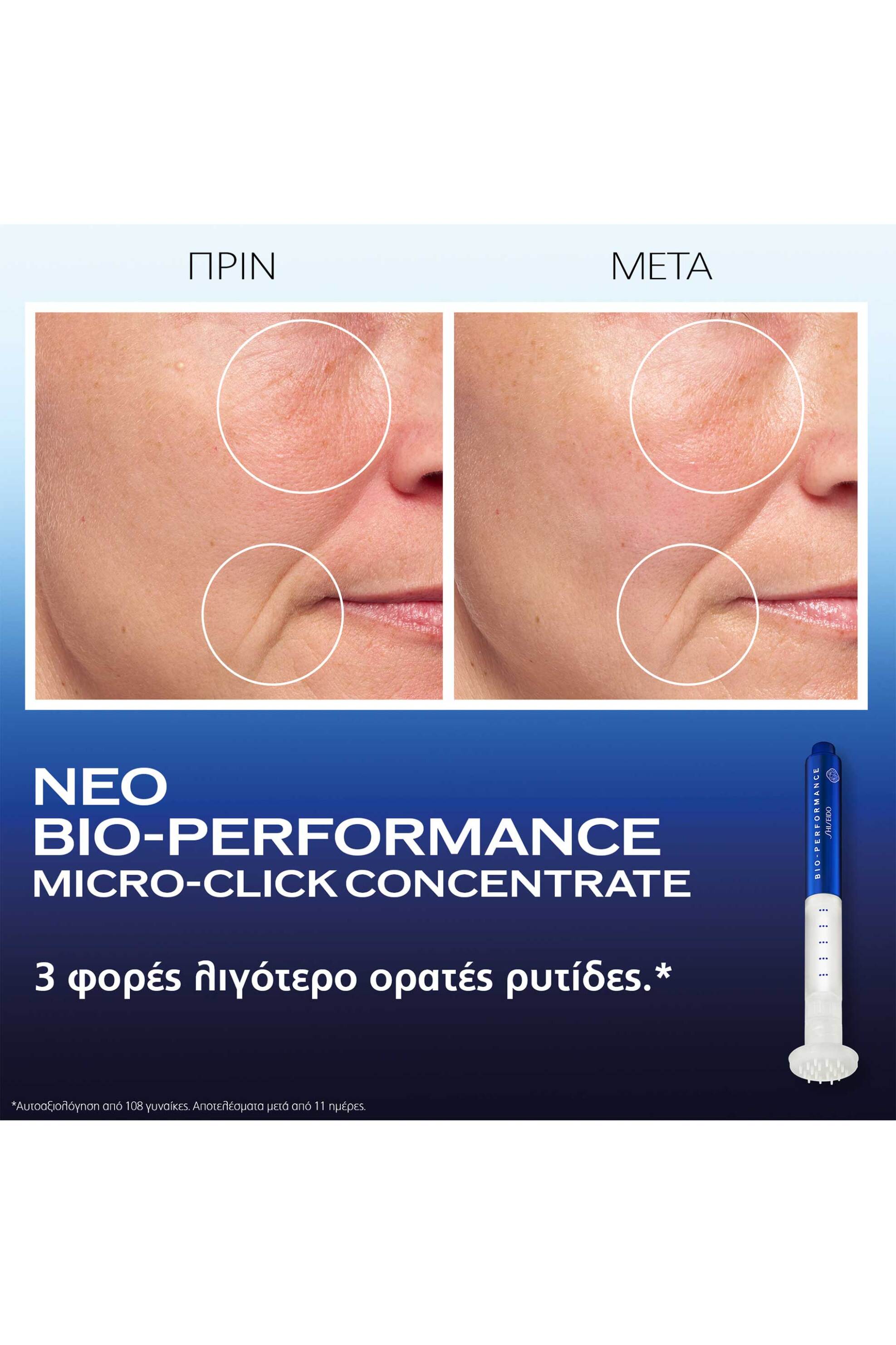 Shiseido Bio-Performance Micro-Click Concentrate (1,4 ml X6 Micro Needle Heads) - 06358 φωτογραφία