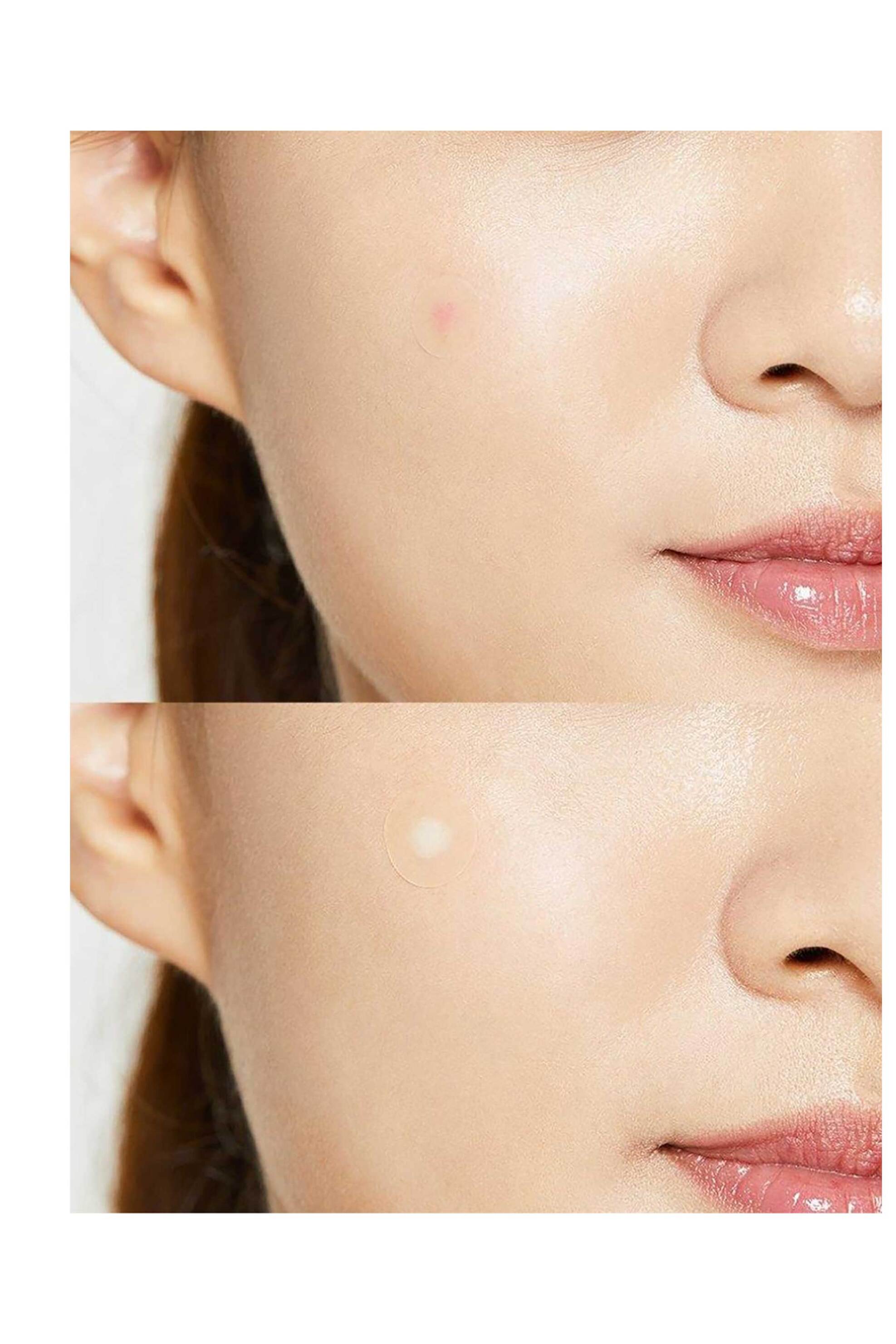 Cosrx Master Patch Original Fit - Επιθέματα Για Την Ακμή (24 τεμάχια) - 8809598455726 φωτογραφία