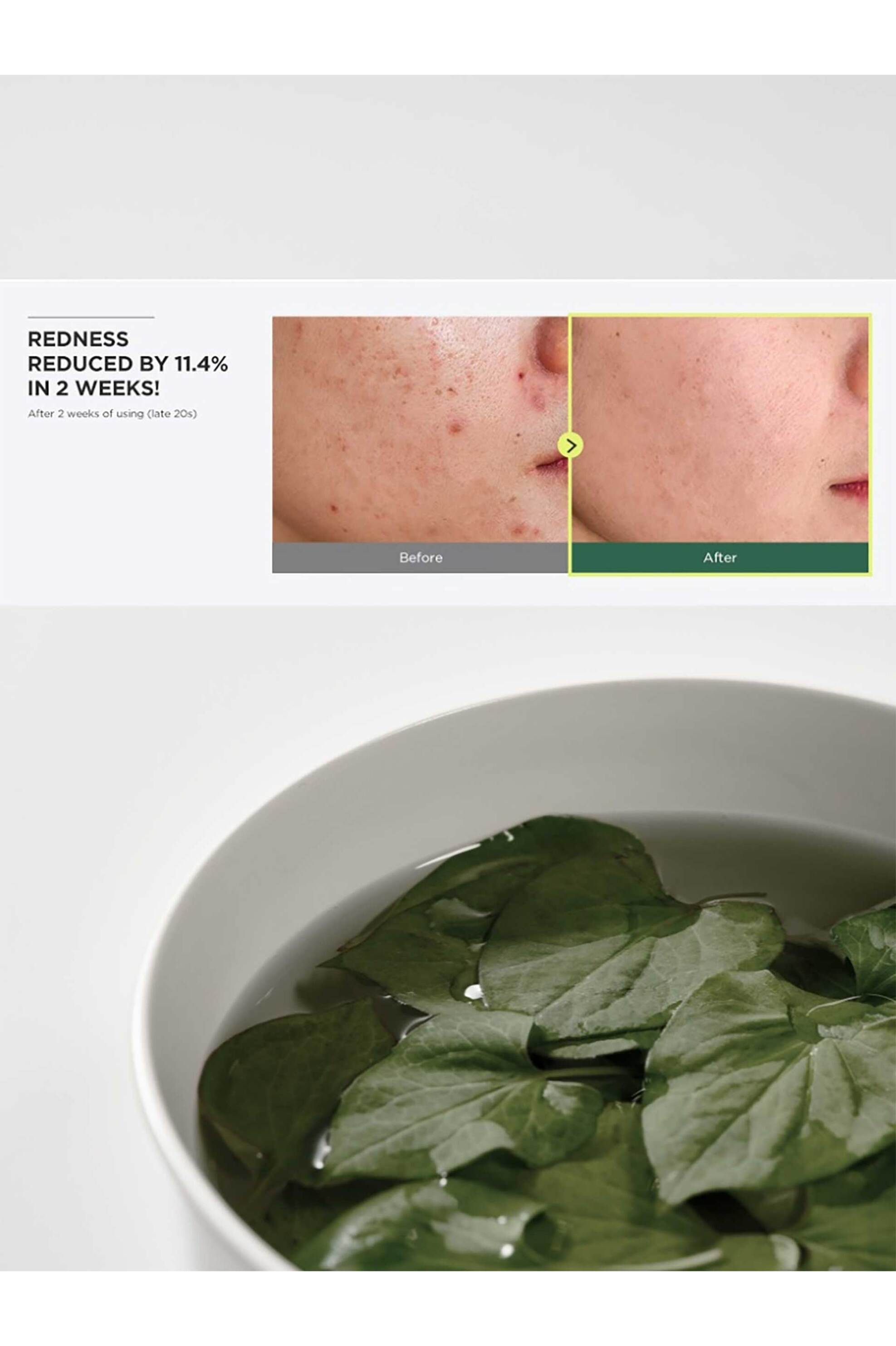 Anua Heartleaf 77% Soothing Toner - 8809640734694 φωτογραφία