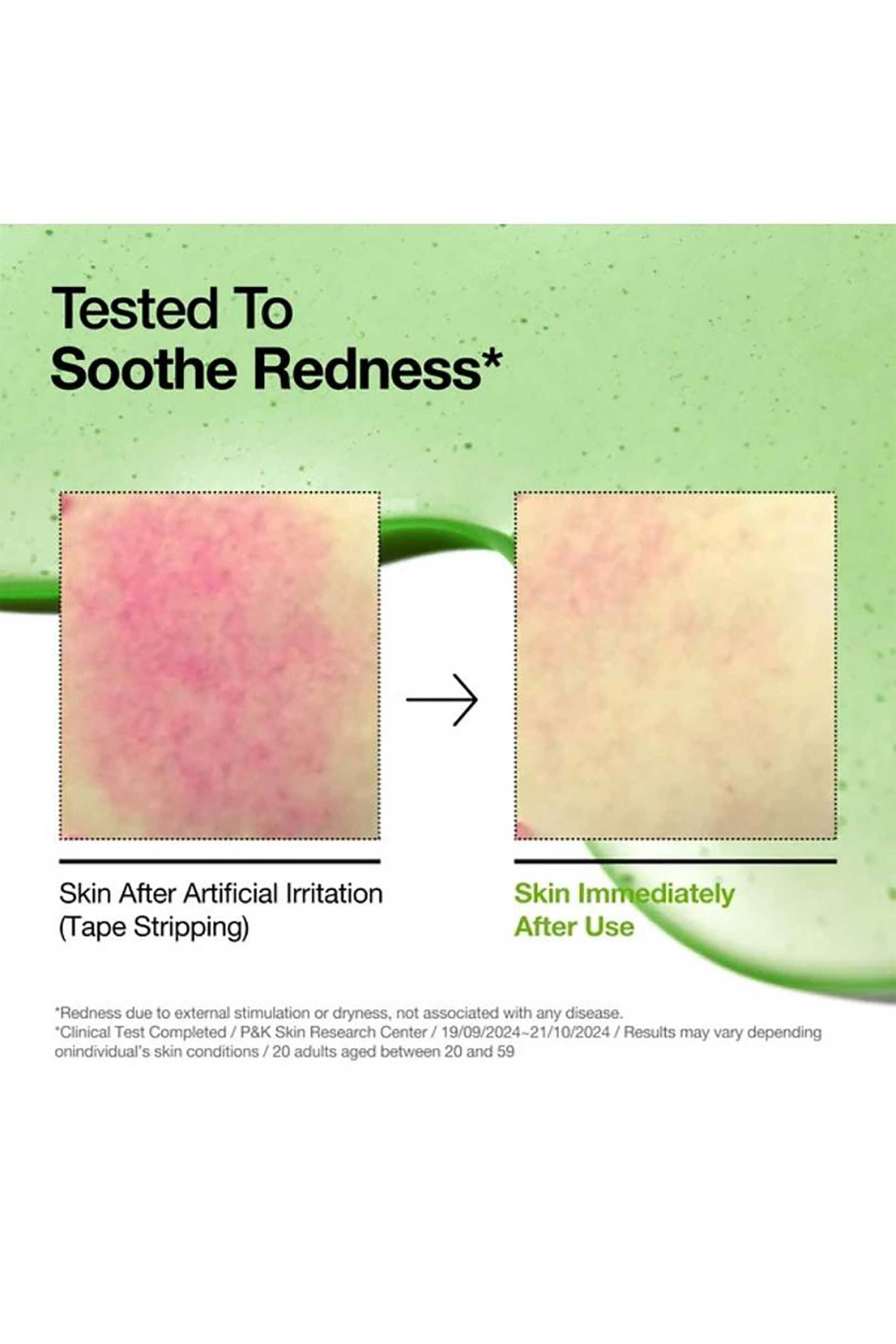 Anua Azelaic Acid 10 Hyaluron Redness Soothing Serum 30 ml - 8809640737190 φωτογραφία