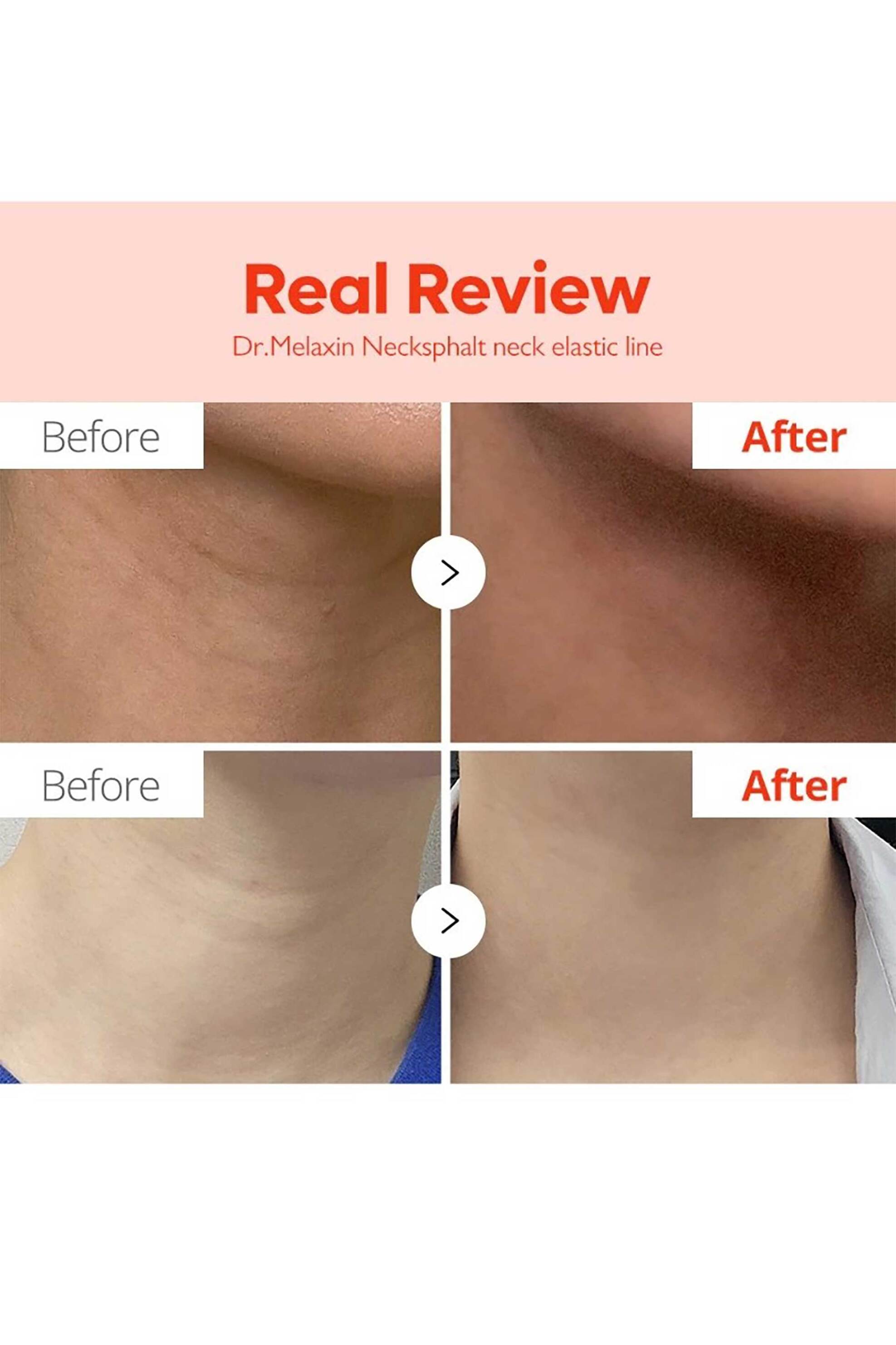 Dr.Melaxin Necksphalt Ecm Ceramide Neck Cream - Συσφικτική Κρέμα Λαιμού 50 ml - 8809886481642 φωτογραφία