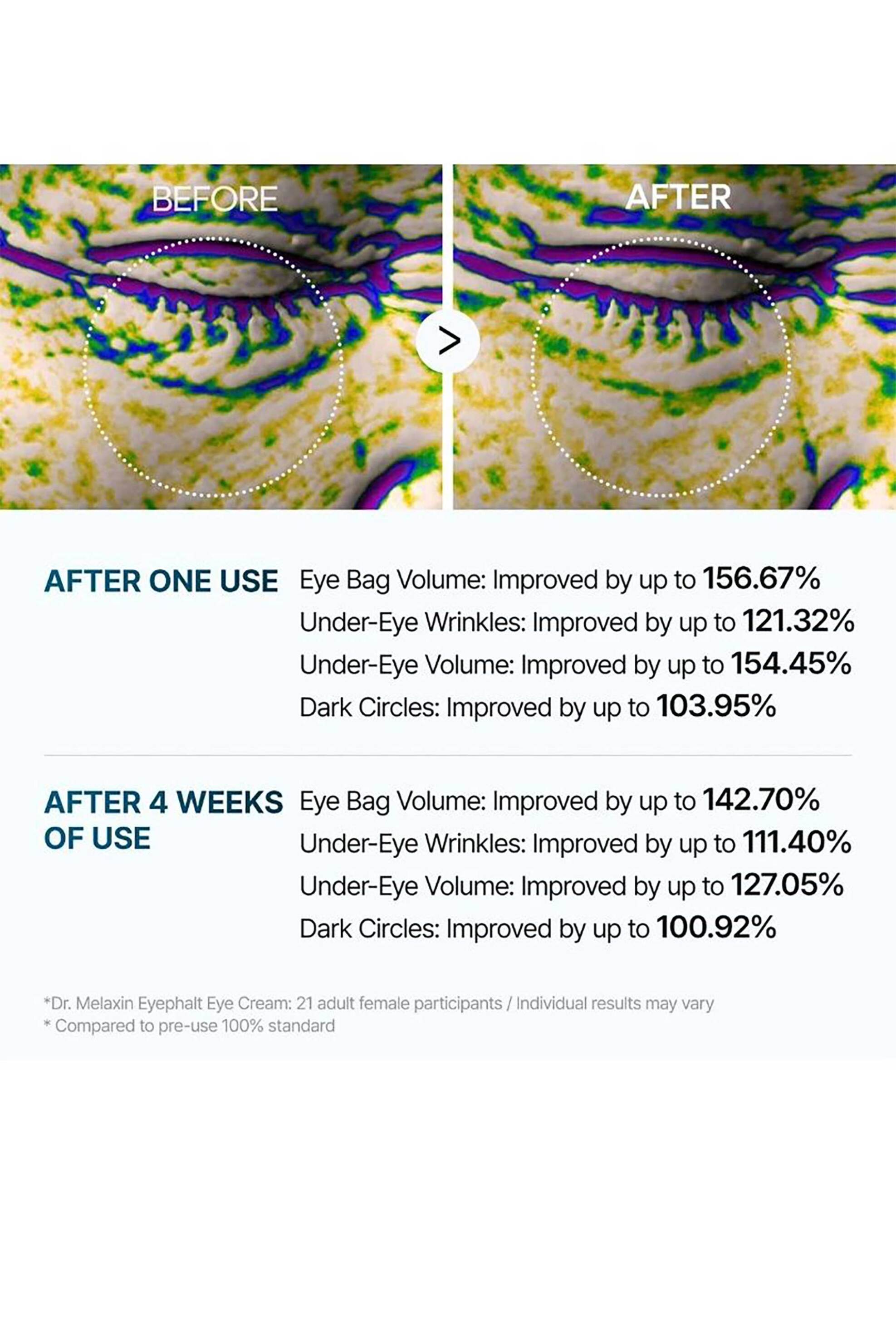 Dr.Melaxin Eyephalt Eyebag Cream - Κρέμα Ματιών Με Αποτέλεσμα Lifting 10 ml - 8809886481932 φωτογραφία