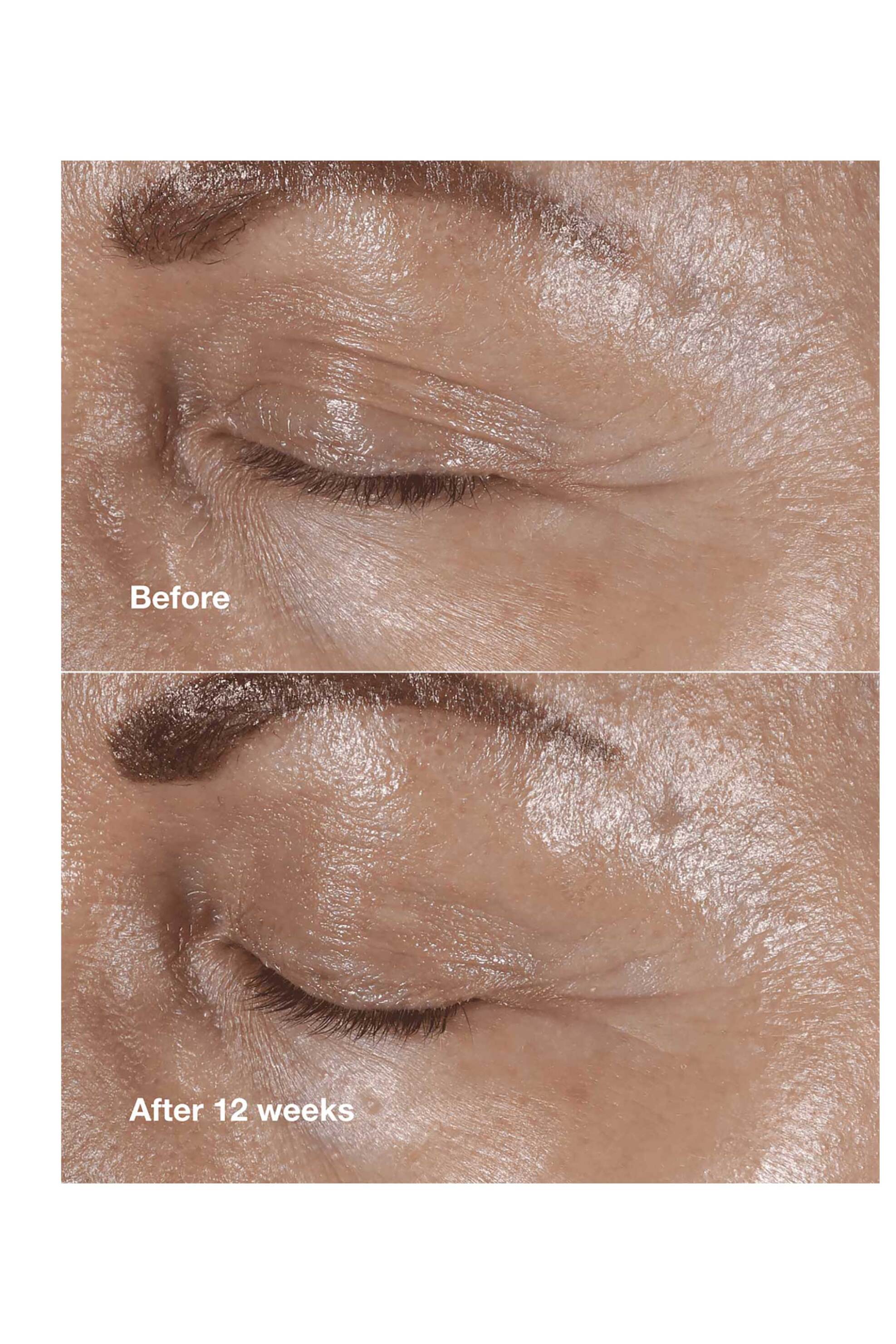 Clinique Smart Clinical Repair™ Wrinkle Correcting Eye Cream 15 ml - V1AX010000 φωτογραφία