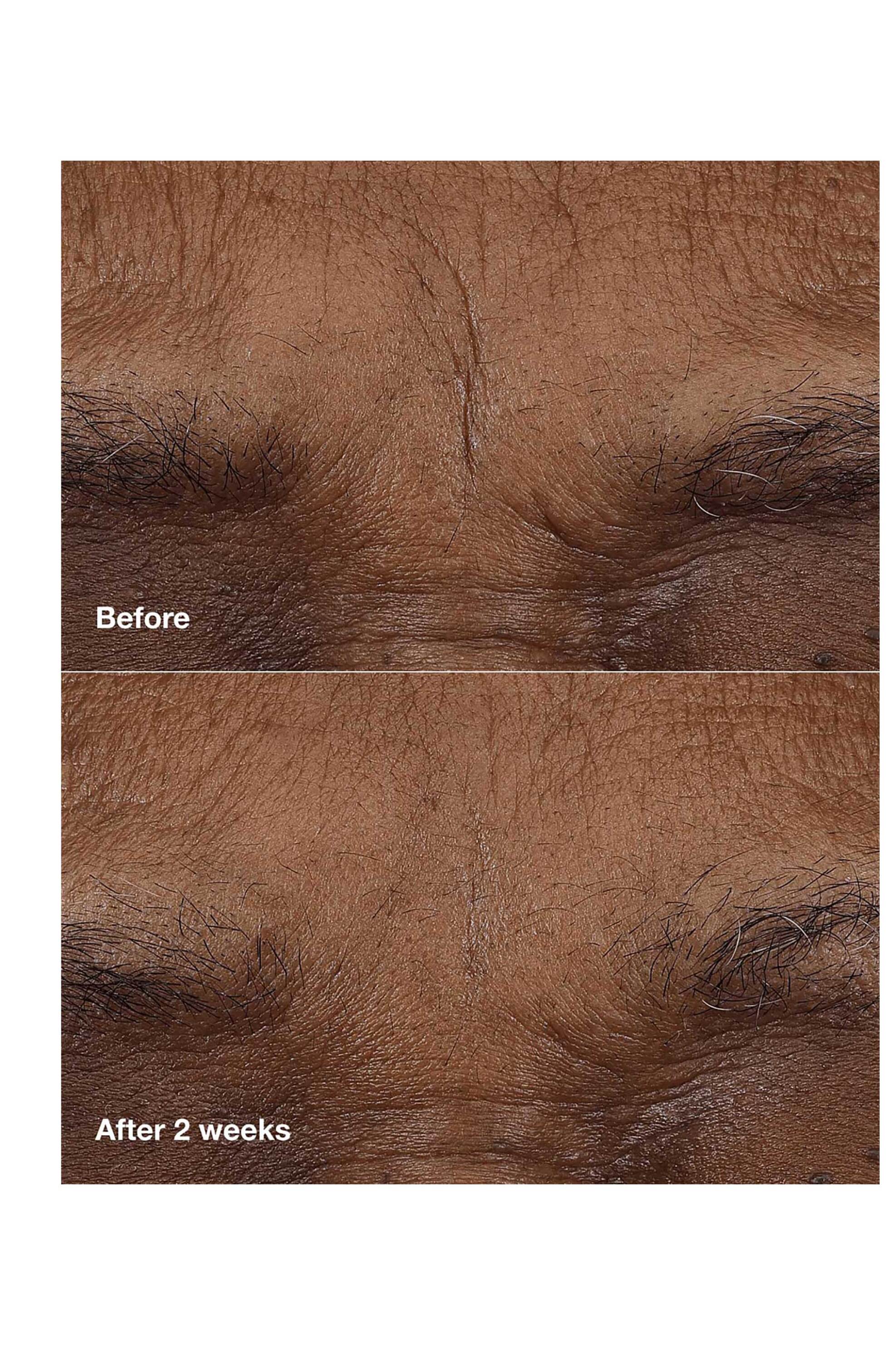 Clinique Smart Clinical Repair™ AM/PM Retinoid Balm 3 gr - V33D010000 φωτογραφία