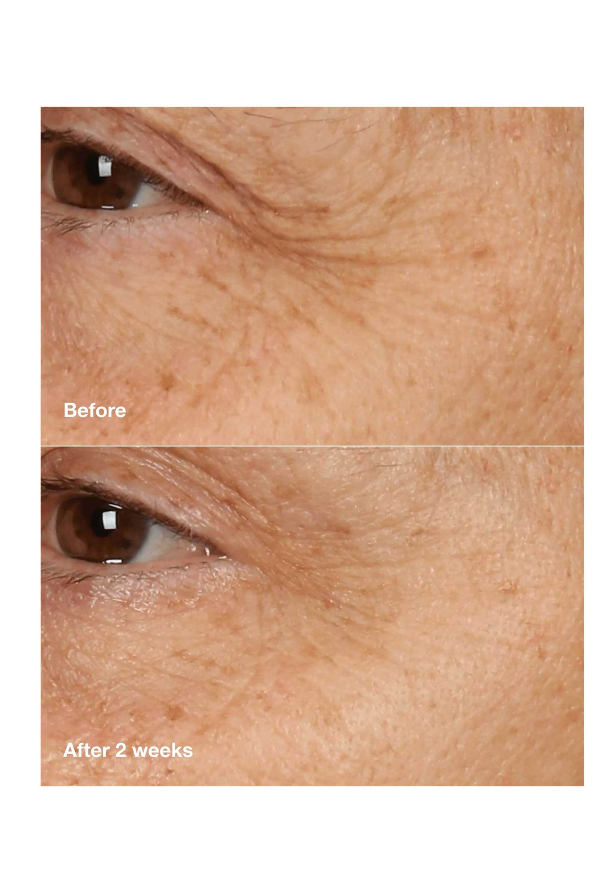 Clinique Smart Clinical Repair™ Overnight Recovery Cream + Mask 50 ml - V36Z010000 φωτογραφία